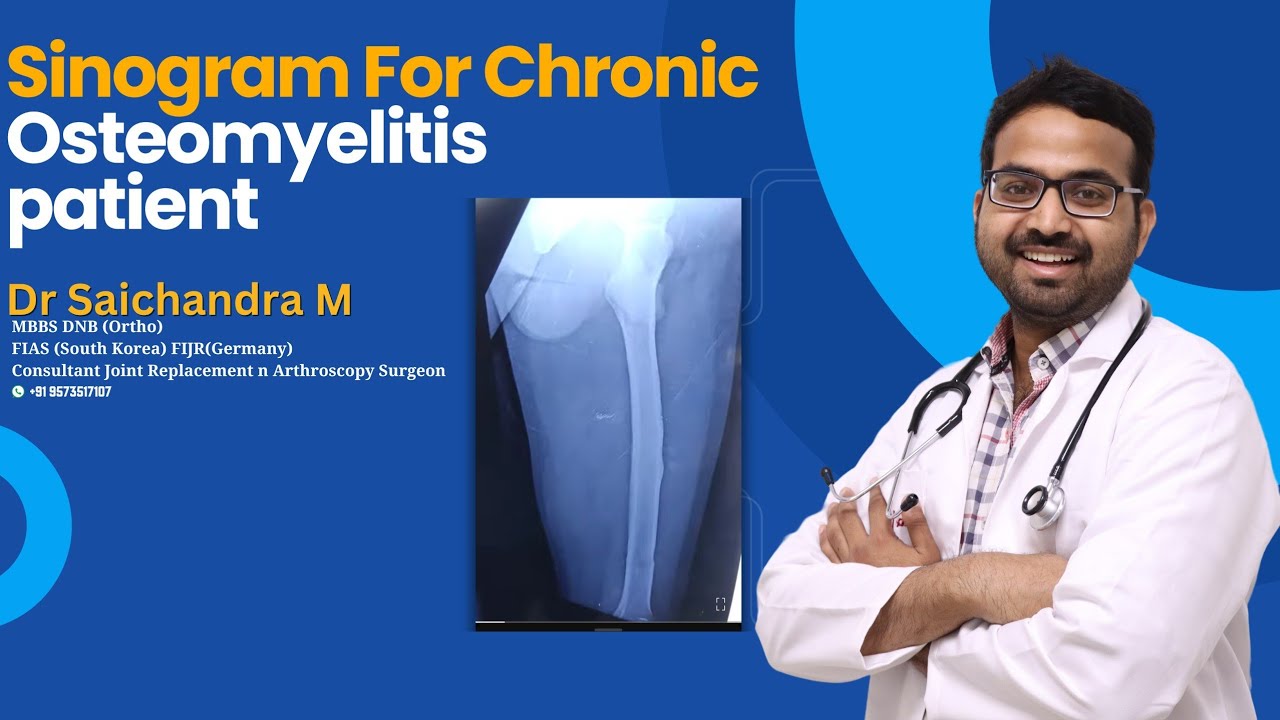 Sinogram For Chronic Osteomyelitis patient...Dr Sai Chandra