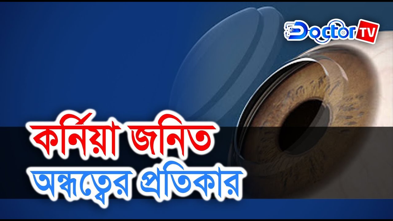 কর্নিয়া নষ্ট হওয়ার কারণ || Cornea || Doctor Tv