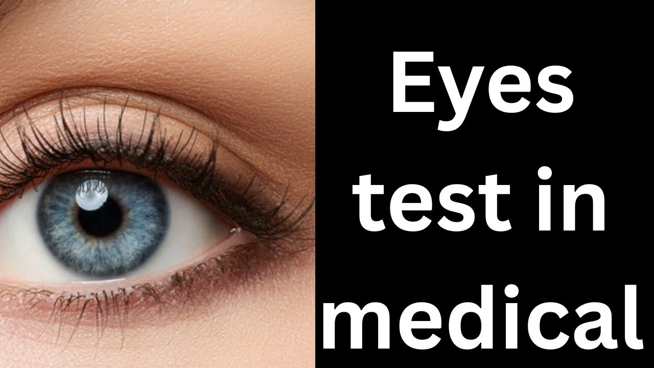 My experience of eyes test in SBI JA Medical | #sbi #sbiclerk #motivation