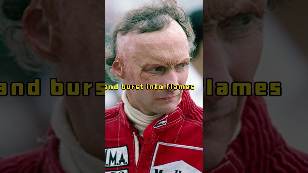 Niki Lauda The Unbelievable Comeback After a Fiery F1 Crash!