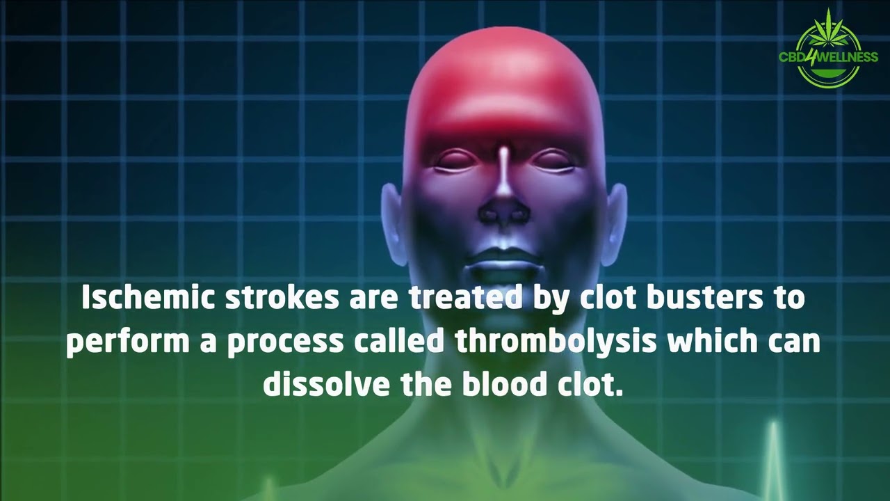 CBD and Stroke recovery