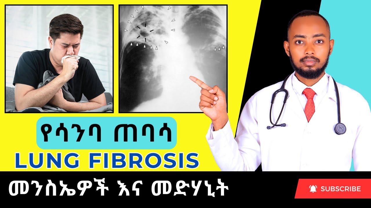 Ethiopia |🚨 መታየት ያለበት! የሳንባ ጠባሳ በሽታ ምልክቶች፣ ምክንያቶች እና መፍትሄዎች (LUNG FIBROSIS)