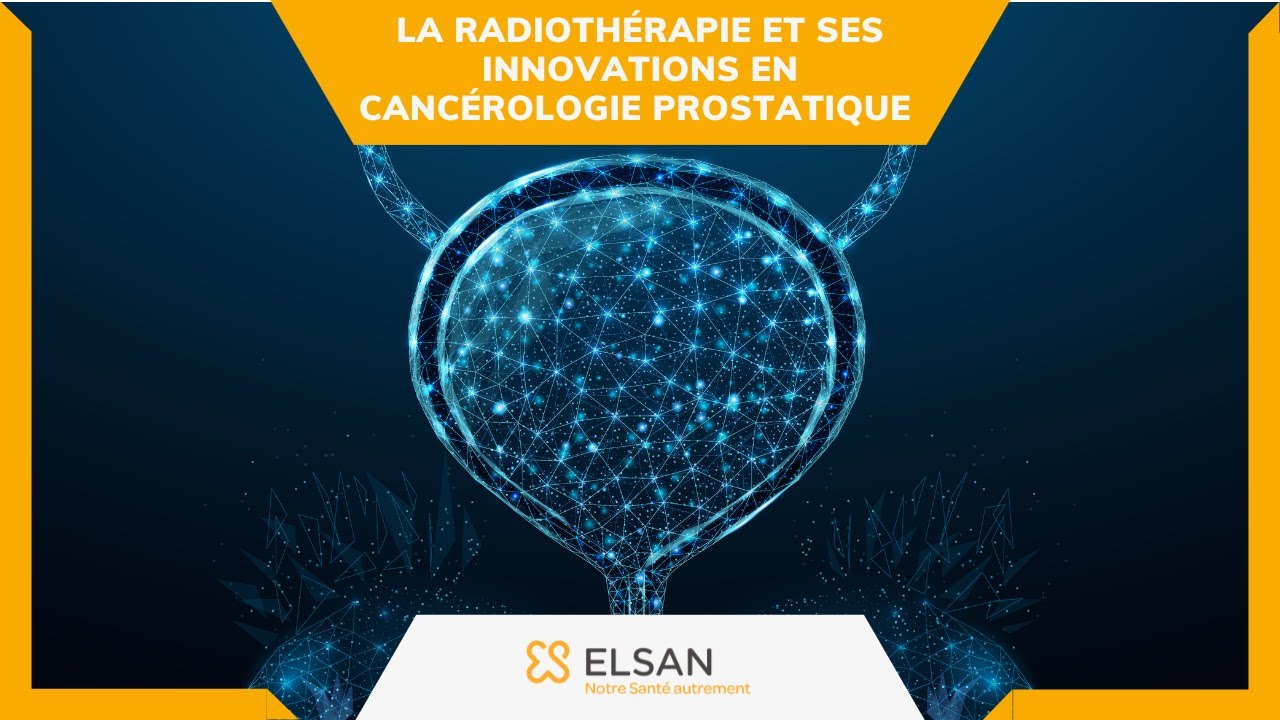 Cancer de la prostate :  la radiothérapie et ses innovations en cancérologie prostatique