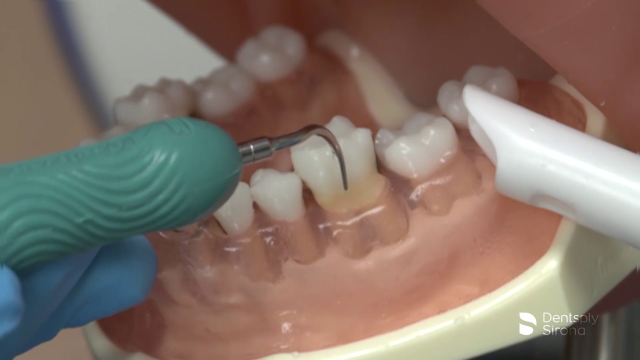Cavitron® Insert Portfolio | Dentsply Sirona