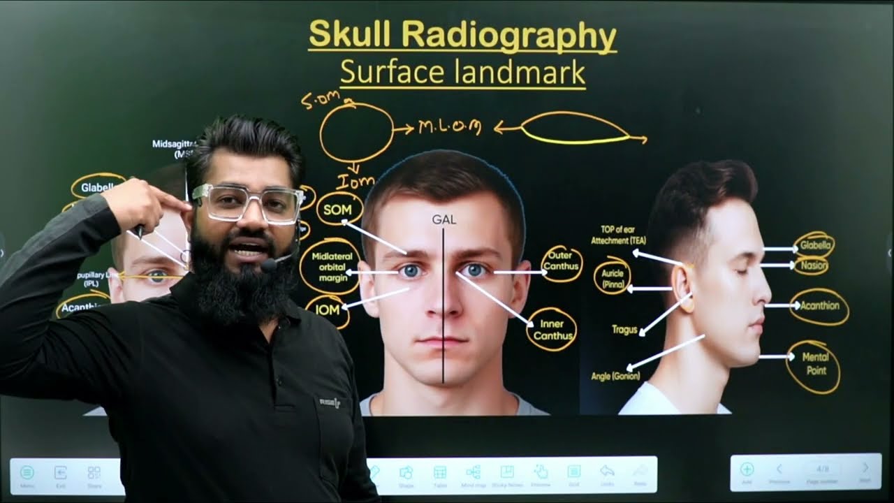 Skull Surface Landmark and Lines || Part -1 || Radiographic Technique || Radiography Made Easy ||