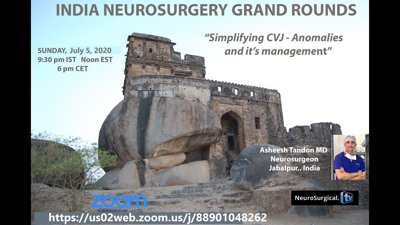 Simplifying CVJ - Anomalies and its management