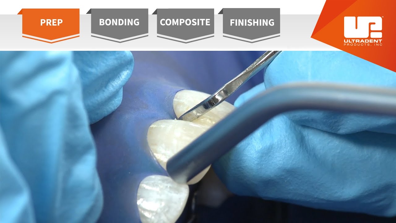 Preparation | Your Complete Restorative Solution