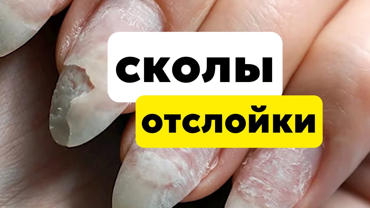ОТСЛОЙКИ, СКОЛЫ, ТРЕЩИНЫ на покрытии/Почему бывают отслойки гель-лака и геля