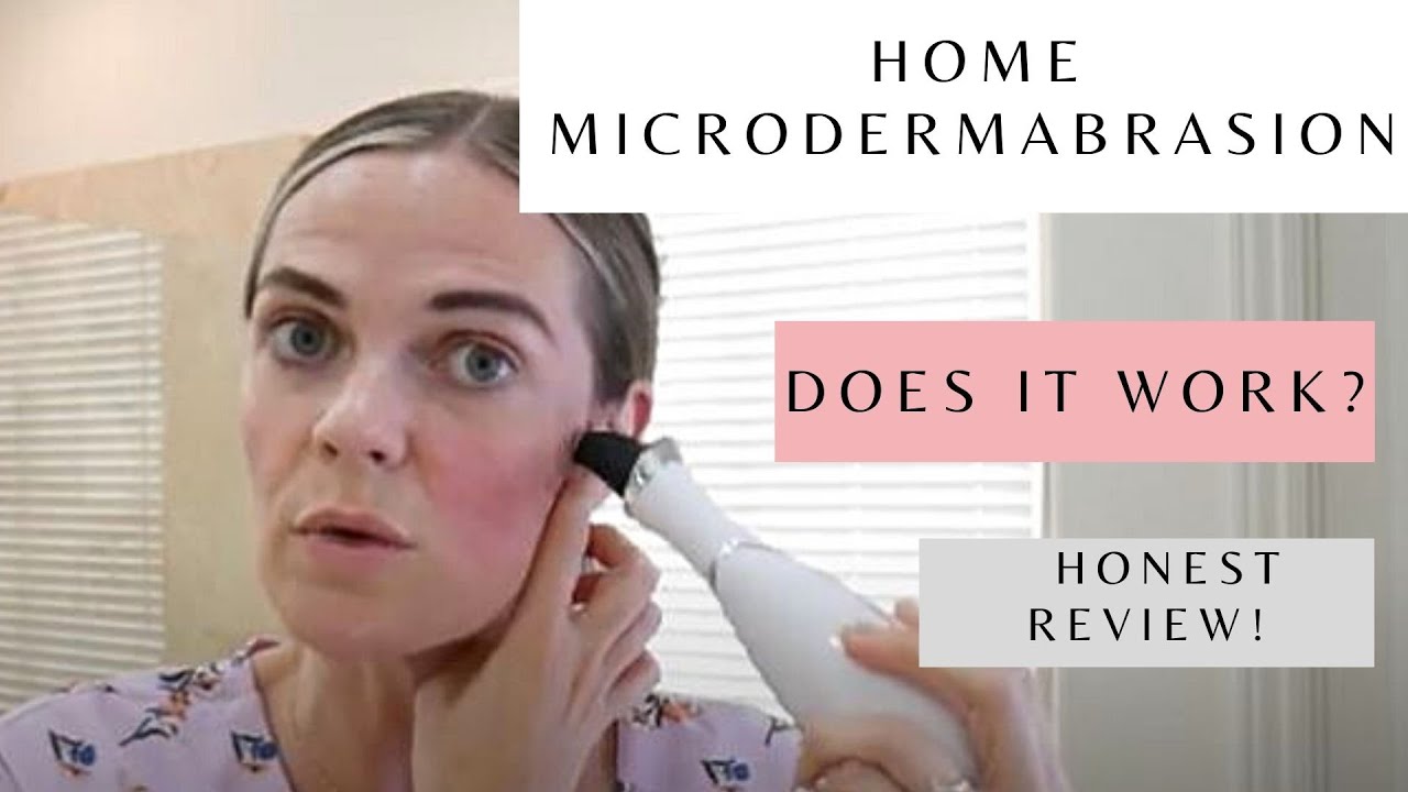 At-Home MicroDermabrasion: Does it work?!