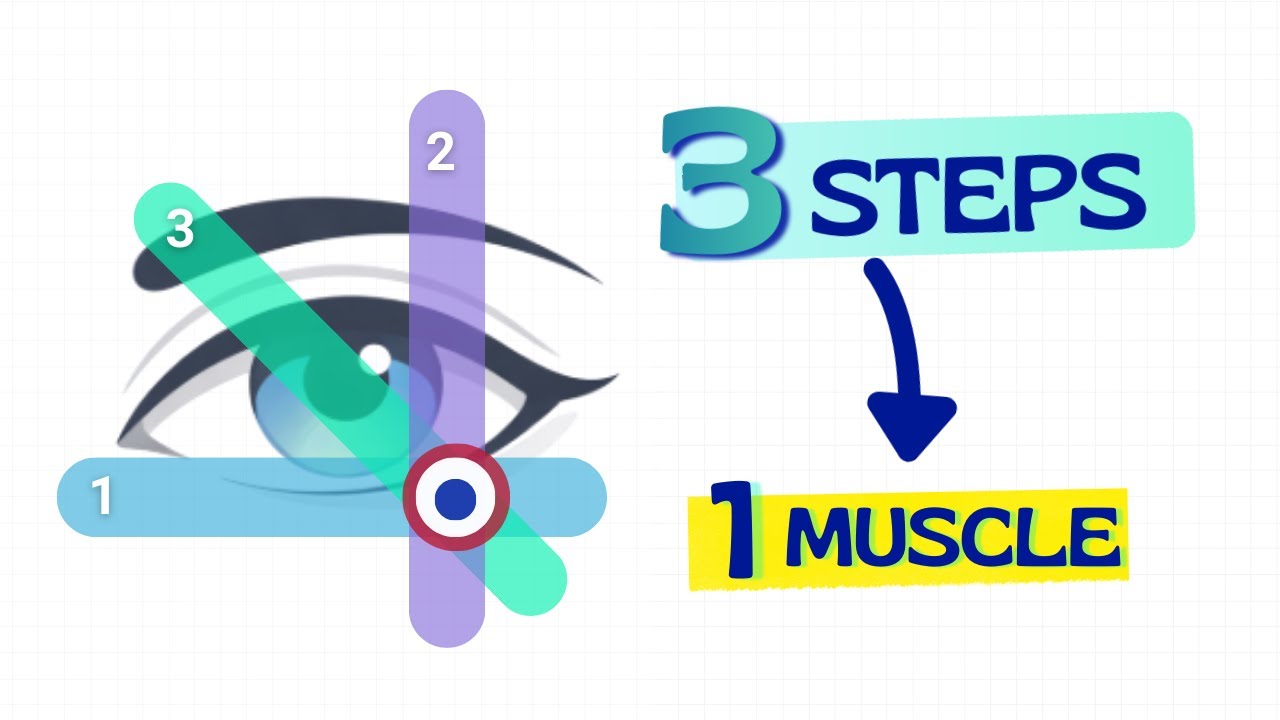 The One Diagram That Solves Every Park’s 3-Step Test (Bielschowsky Head Tilt Test)
