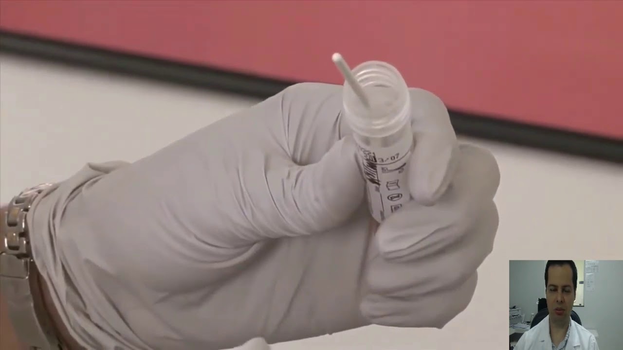 Coleta - Aprenda na prática como colher swabs de nasofaringe e orofaringe da maneira correta