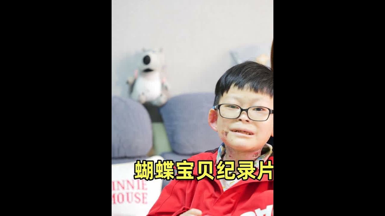妈妈：父母有一天会老去，我最怕自己没有能力照顾儿子 @Summer 陈奕瑜妈妈 #蝴蝶宝贝#罕见病 #纪录片 #妈妈 #坚强的孩子