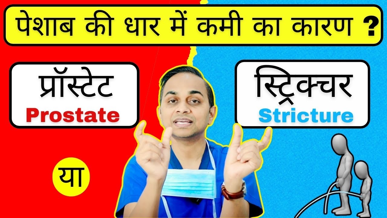 प्रॉस्टेट या स्ट्रिक्चर, क्या है असली वज़ह ? पेशाब नली में सिकुड़न- Stricture Urethra Treatment