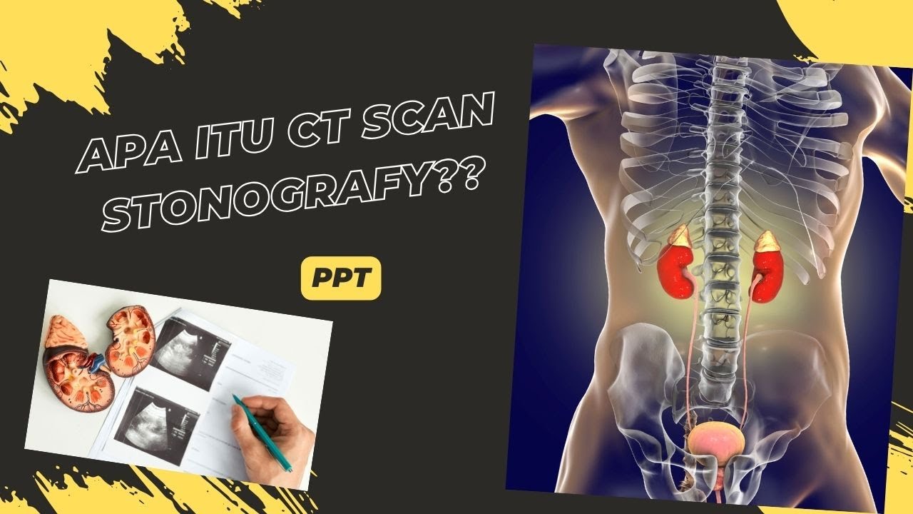 Pemeriksaan CT Scan Urografi, Urology, Stonograpy #urologysurgery