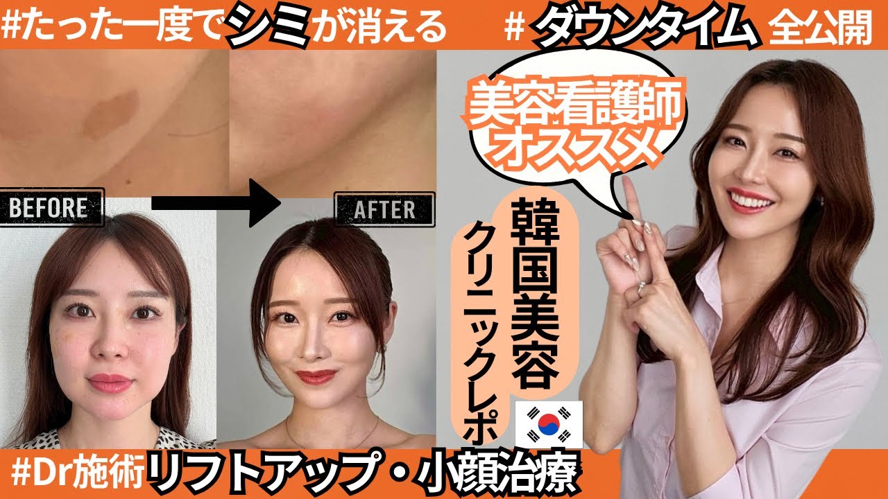 【🇰🇷韓国美容クリニックレポ】⚠️金ドブ回避！日本語OK。美容看護師驚愕！圧倒的効果の小顔治療、シミ取り、美肌治療、リフトアップ治療。