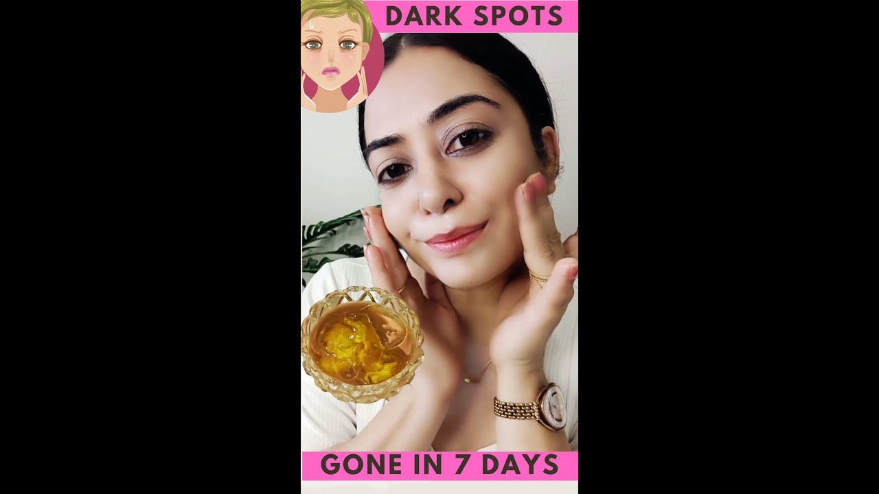 कितनी भी पुरानी झाइयां, Pigmentation जड़ से खत्म करें 100% रिजल्ट || How To Remove Pigmentation
