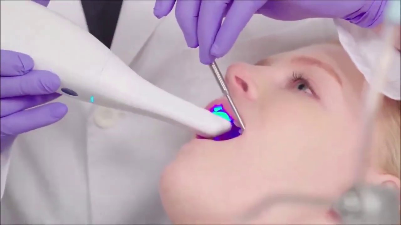 Amprentare dentară digitală @Stomalux