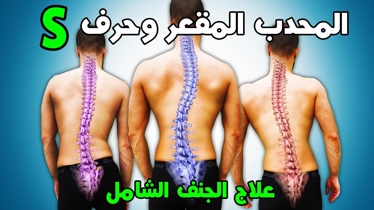 دليلك الشامل لعلاج الجنف: تحديد المقعر والمحدب وحرف S | قياس طول الأرجل | وضعية النوم | التمارين