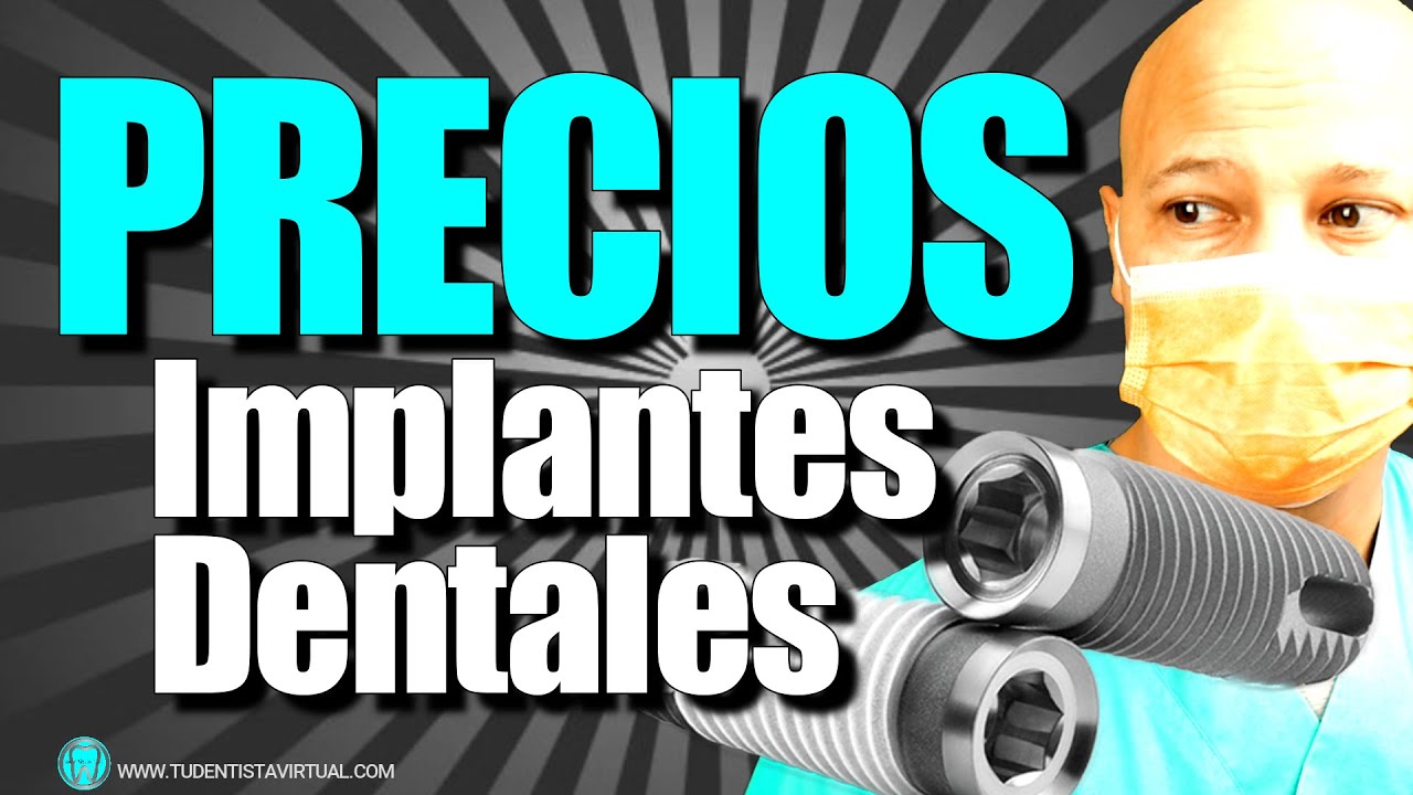 Cuanto CUESTAN los IMPLANTES? (PRECIO TRATAMIENTOS 💰💲)