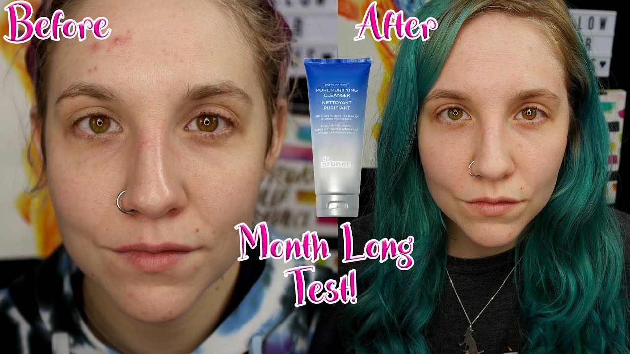 Dr. Brandt Pores No More Purifying Cleanser | Month Long Test | Before and After Results