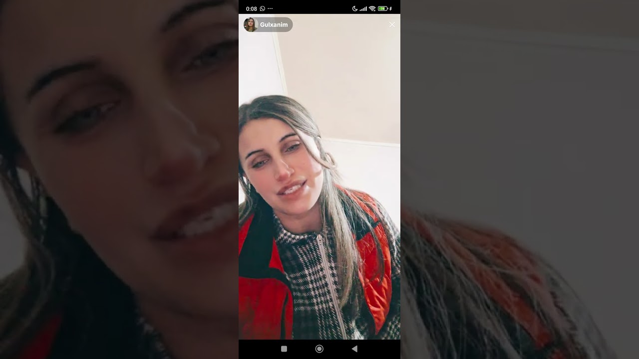 GÜLXANIM ESTETİK ƏMƏLİYYAT ELƏTDİRDİ.BU ƏMƏLİYYAT UŞAQLARDAN ÖNƏMLİDİR?🤔🤔