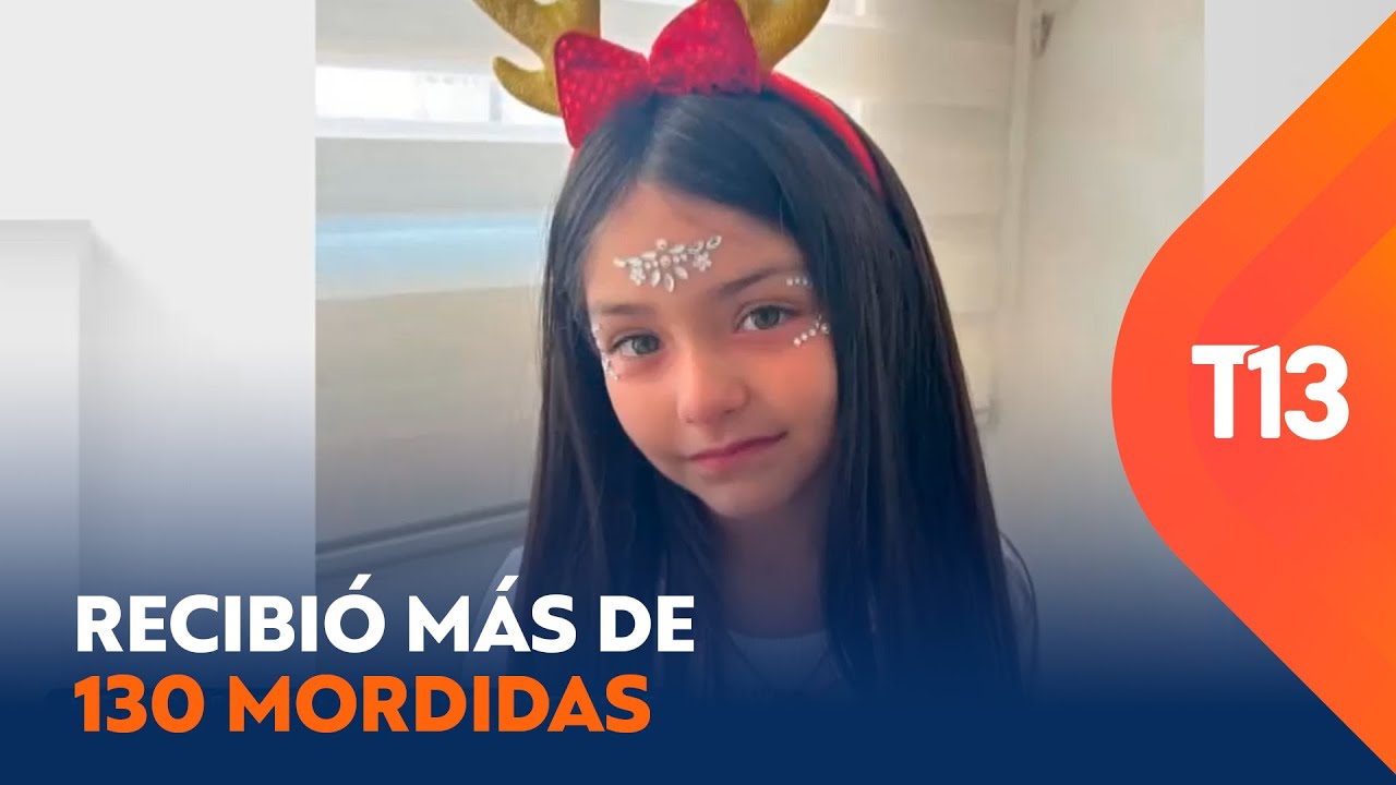 El impactante relato de la madre de niña atacada por los perros de su abuelo