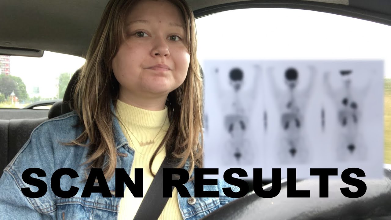 The Size Of My Tumor || Cancer Update