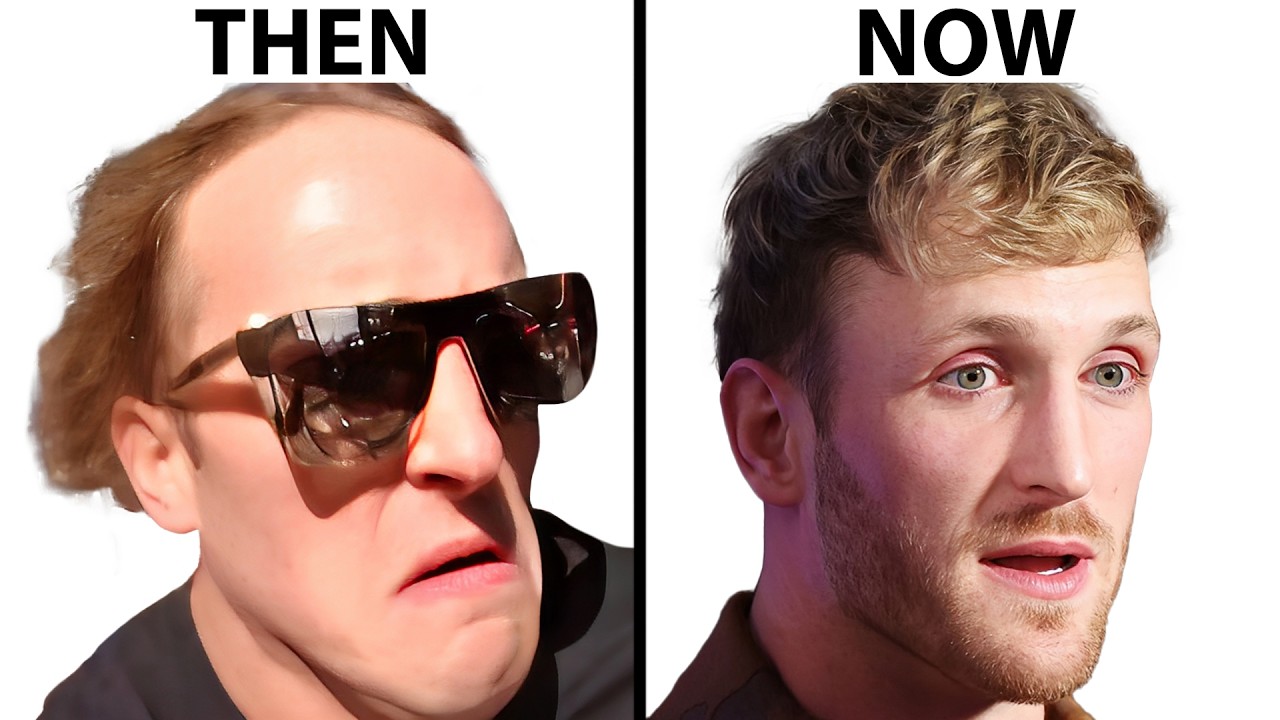 Logan Paul’s SHOCKING Hair Regrowth | Hair Surgeon Reacts
