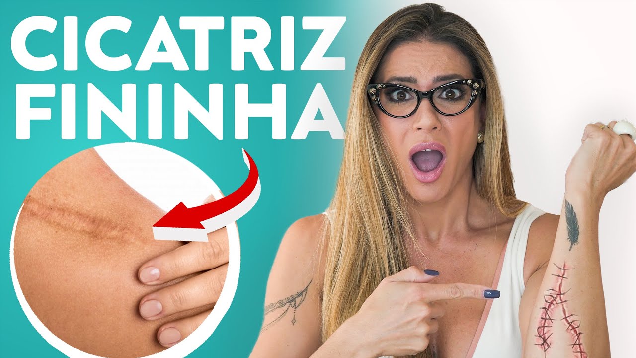 COMO DEIXAR A CICATRIZ BEM FINA | LILI SPADA