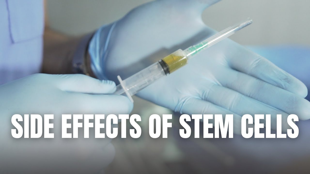 The ACTUAL Side Effects Of Stem Cells (WATCH BEFORE YOU GO)