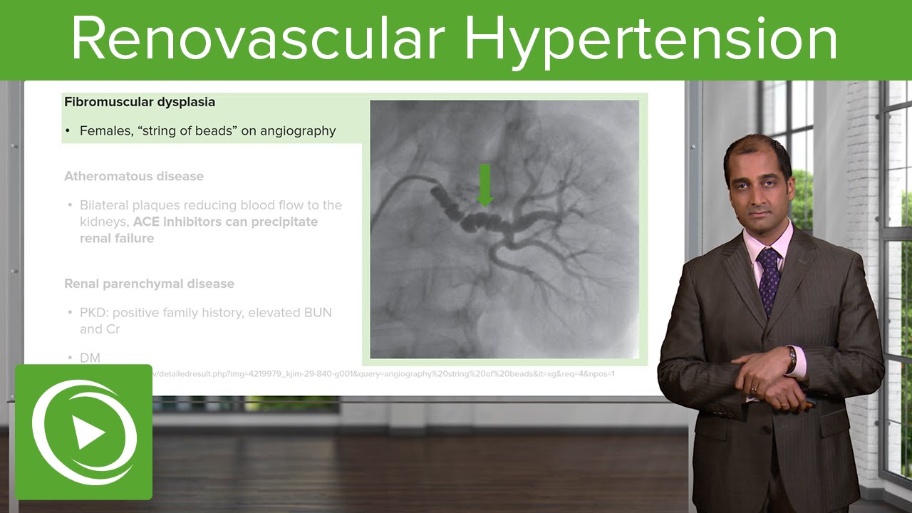 Renovascular Hypertension – Cardiovascular Pathology | Lecturio