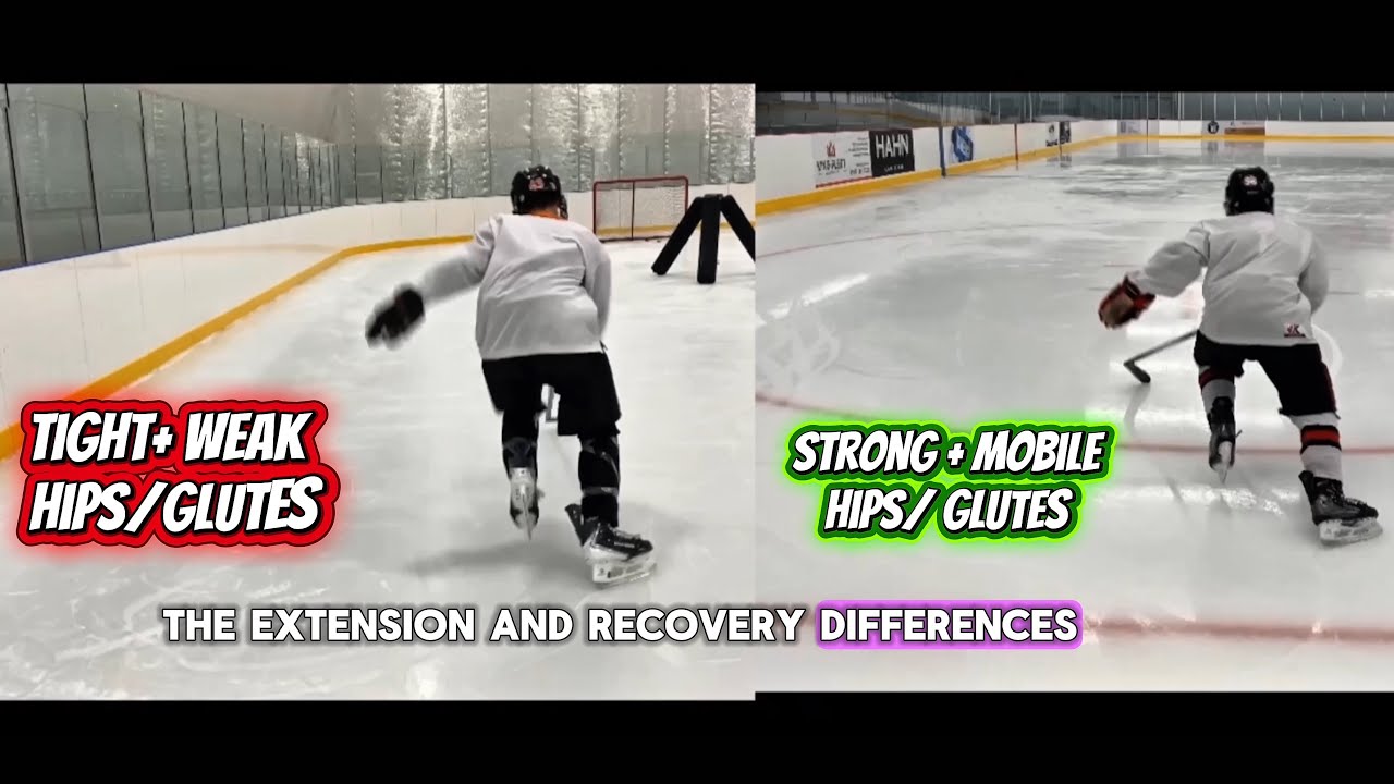 ACCELERATION MECHANICS- TIGHT/WEAK VS STRONG/ MOBILE HIPS