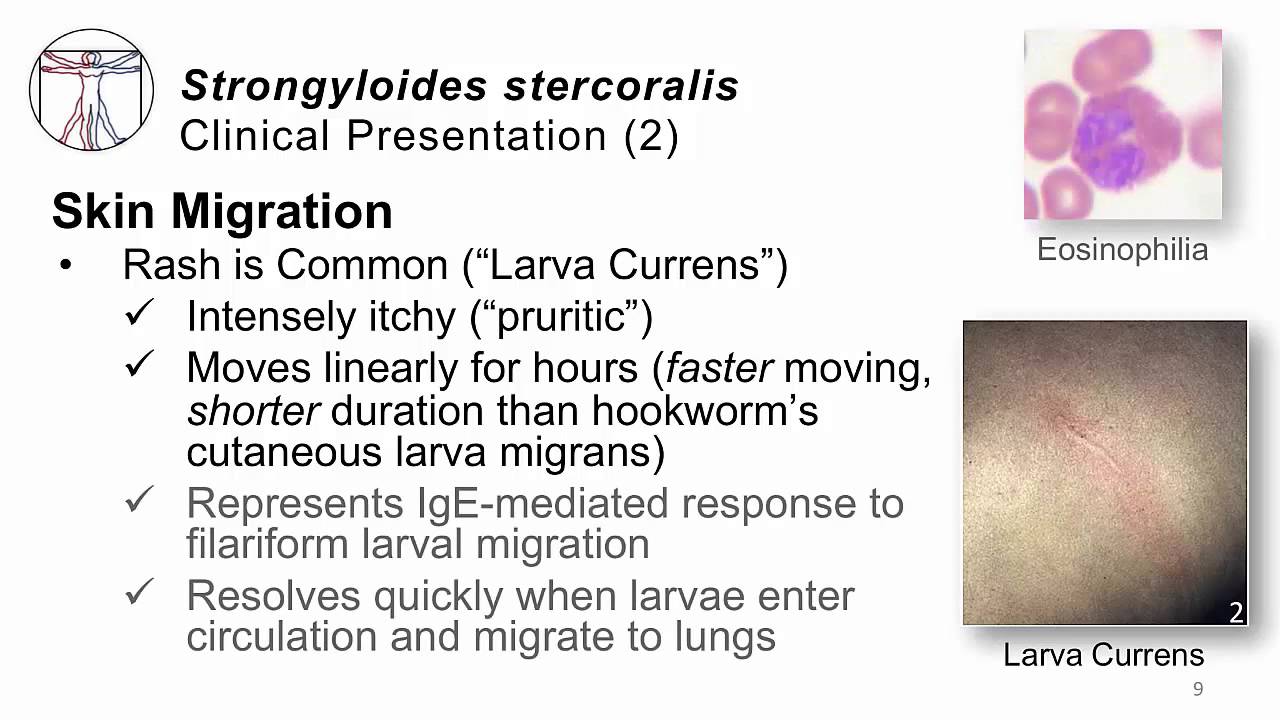 Helminths Strongyloides