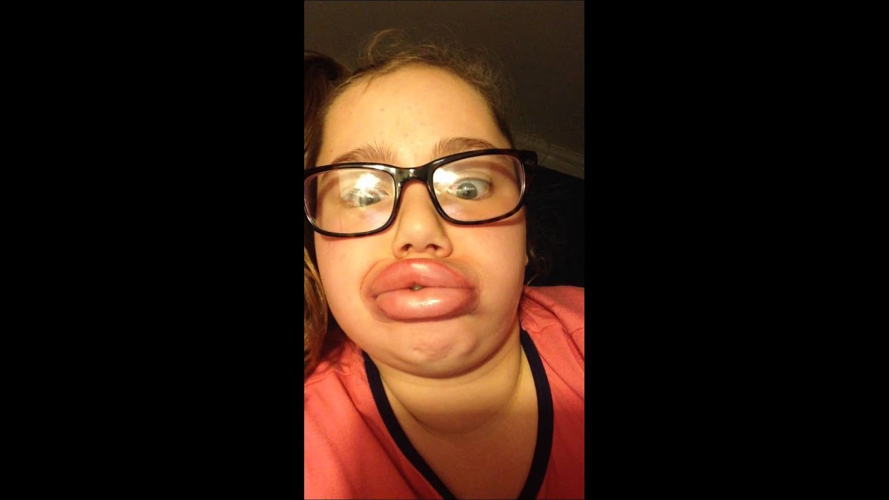 Kylie Jenner lip challenge fail