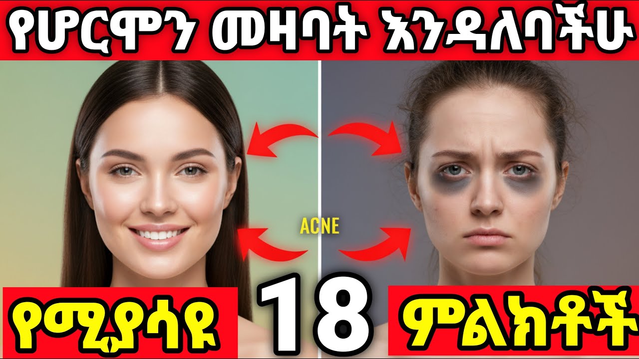 የሆርሞን መዛባት እንዳለባችሁ የሚያሳዩ ማስጠንቀቂያ ምልክቶች |
