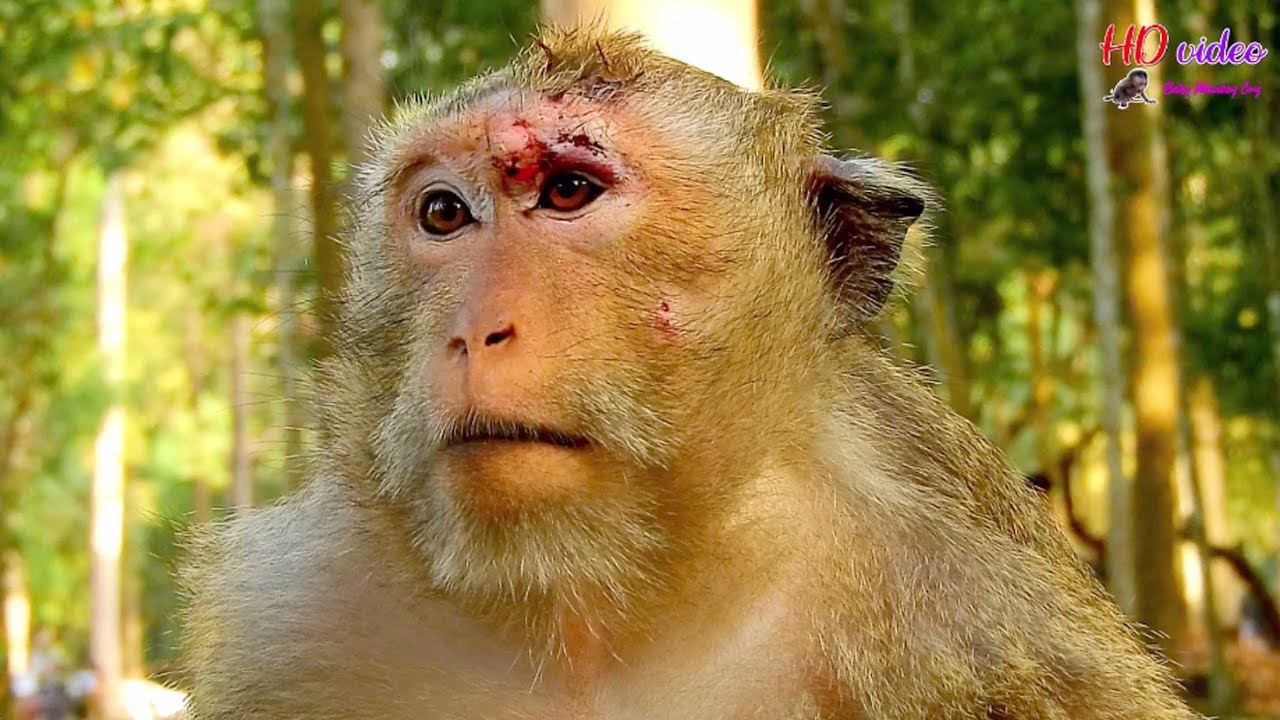 Result mom Daisy after lost fighting with her daughter April, Daisy now very hurt wound