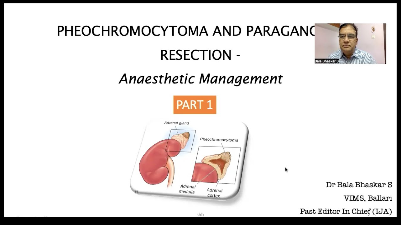 Pheochromocytoma and Anesthesia Part 1 Bala Bhaskar