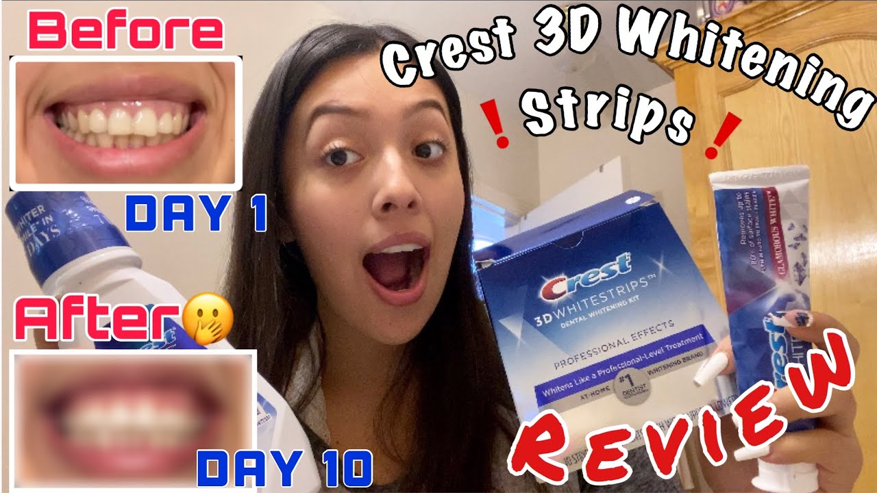 TESTING 3D WHITE STRIPS IN 10 DAYS! Do they work? | THATS ALO