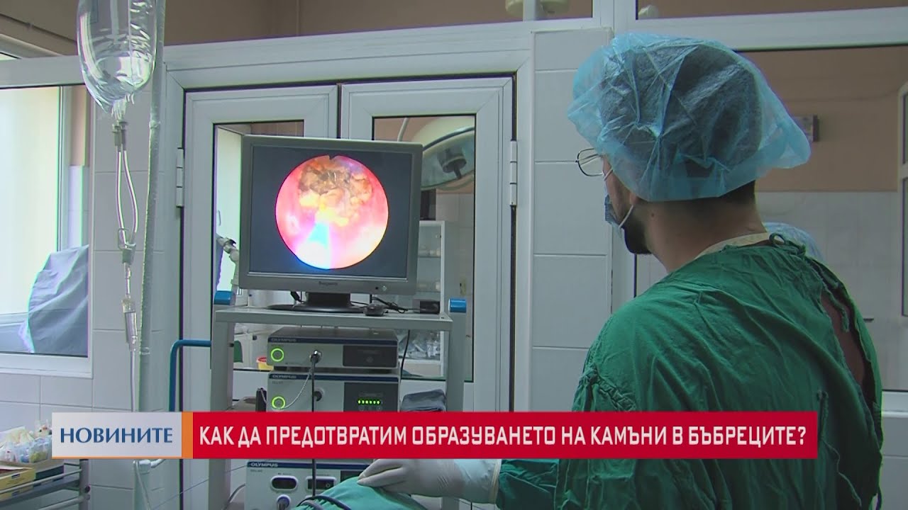 Как да предотвратим образуването на камъни в бъбреците?