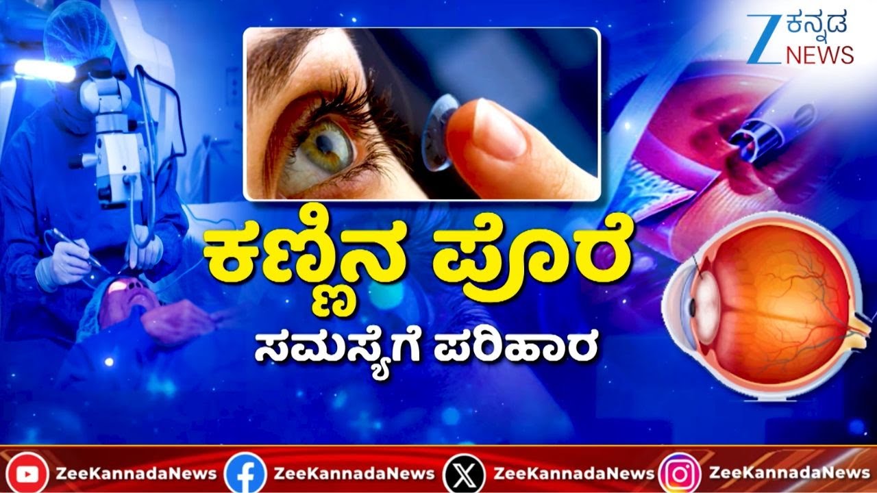 Opthalmology | What Are Cataracts? | ಕಣ್ಣಿನ ಪೊರೆ ಶಸ್ತ್ರಚಿಕಿತ್ಸೆ ಹೇಗಿರುತ್ತೆ..?