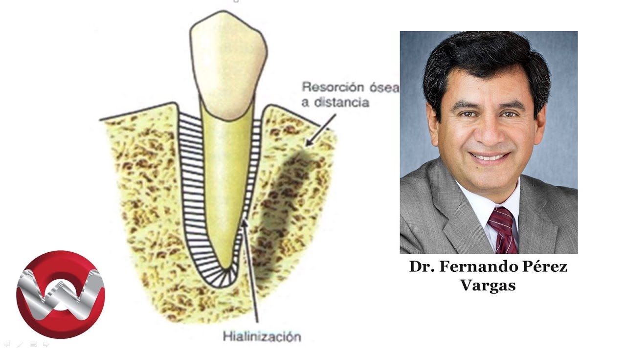 Fisiología del movimiento dentario