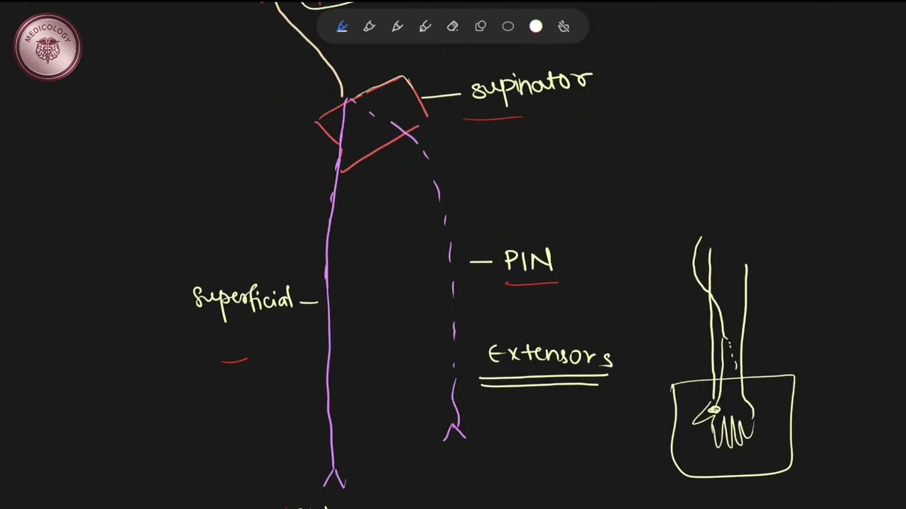 Radial nerve 