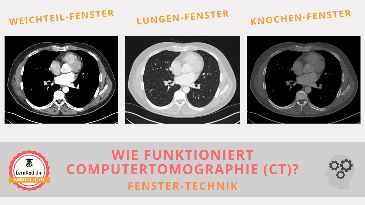 Wie funktioniert CT? Fenstern und 