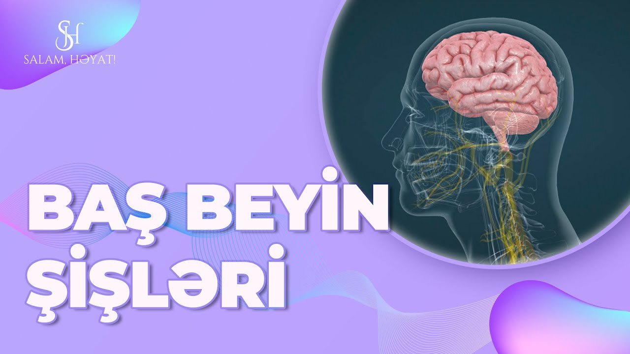 BAŞ BEYİN ŞİŞLƏRİ / ƏLAMƏTLƏRİ VƏ MÜALİCƏSİ - SALAM HƏYAT.