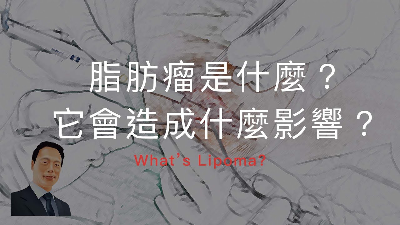 脂肪瘤是什麼？它會造成什麼影響？