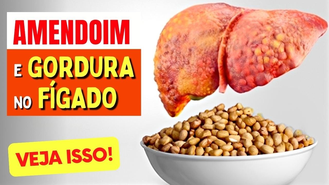 AMENDOIM e GORDURA NO FÍGADO -  O que você PRECISA SABER!