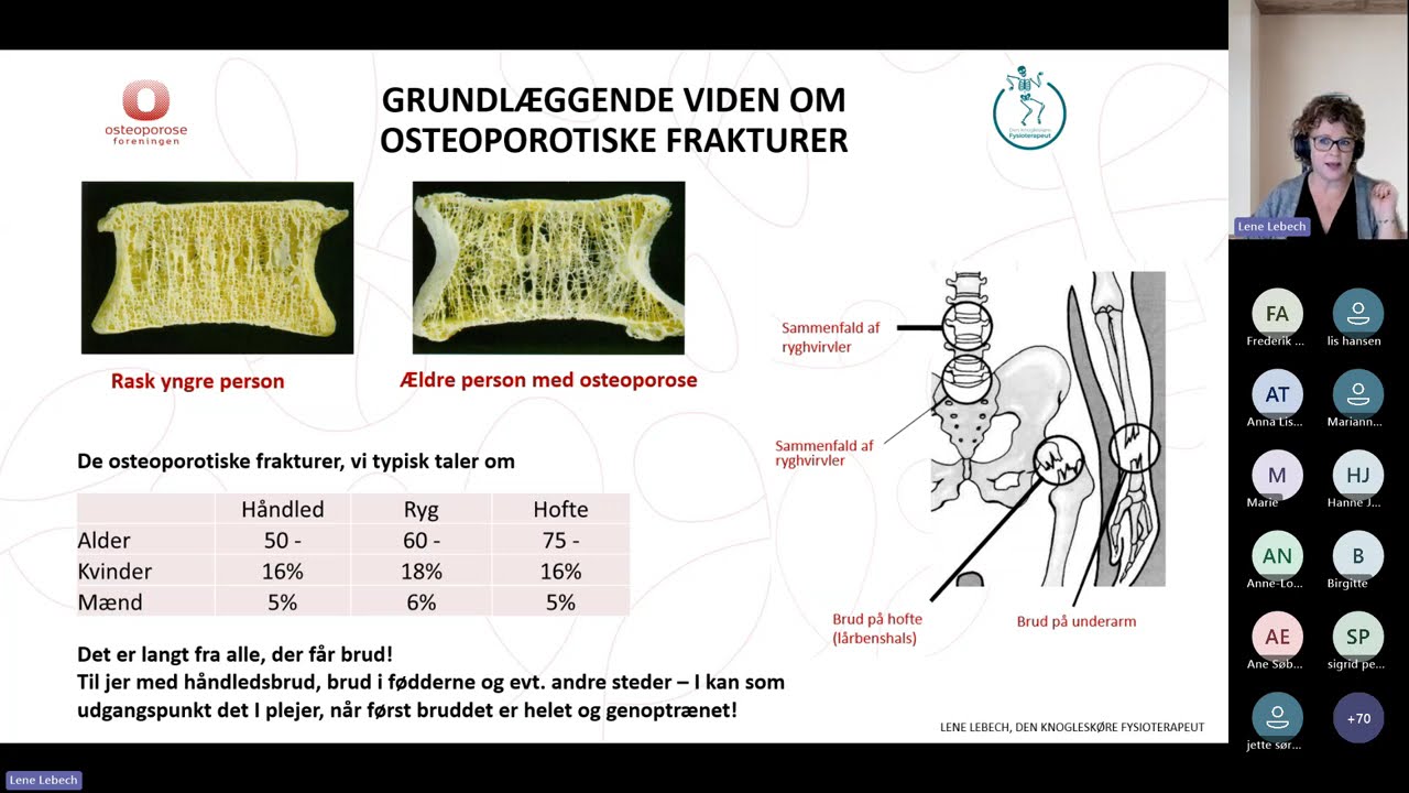 Digitalt kursus: Modul 3A - Dagligdagen og træning. For dig med knoglebrud