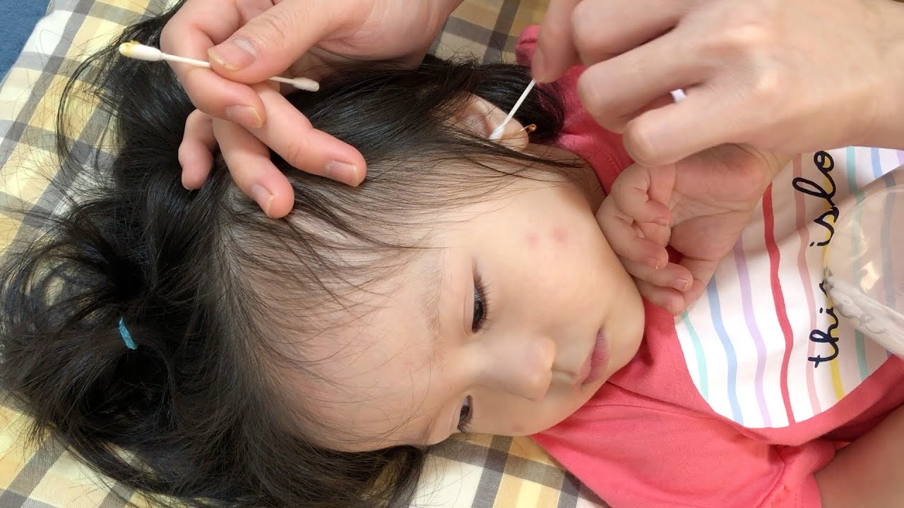 🇯🇵1歳5ヶ月の娘の綿棒耳かき