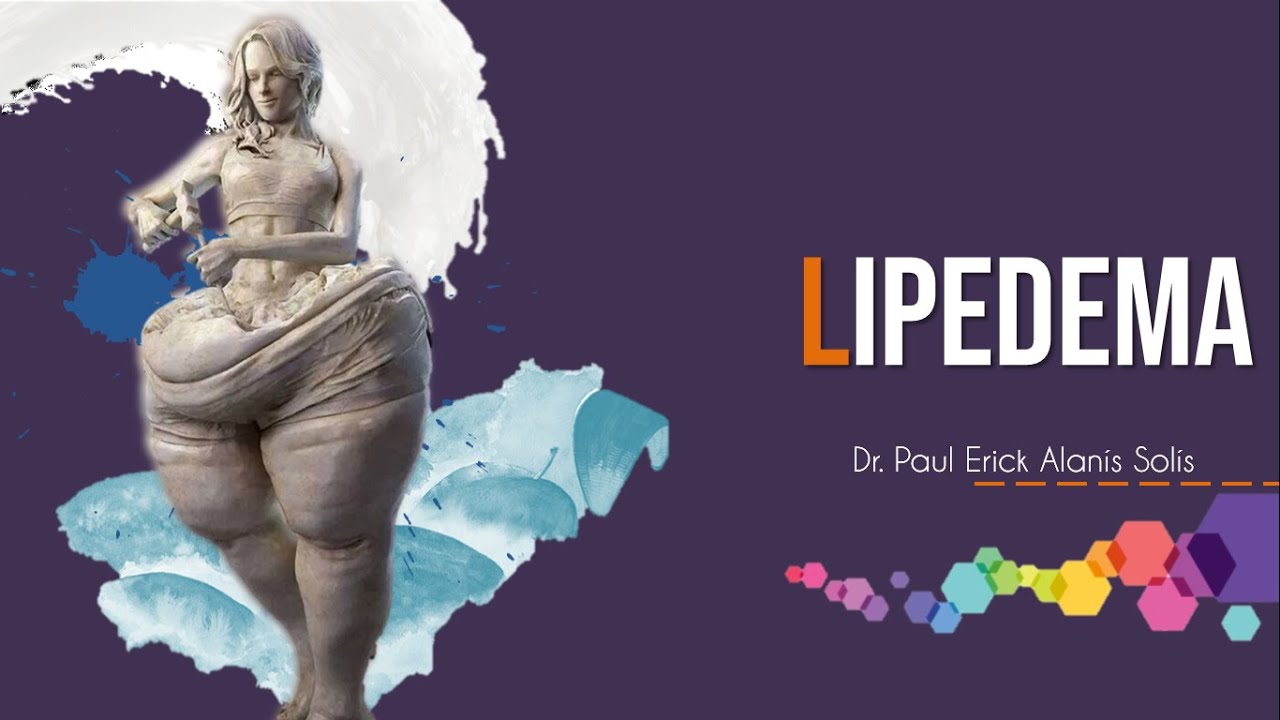 Lipedema