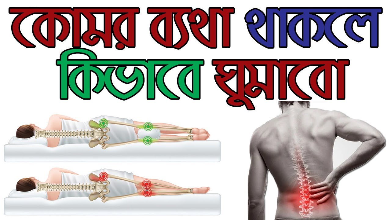 কোমর ব্যথা থাকলে কি ভাবে ঘুমাবেন/ Sleeping position  in a back pain